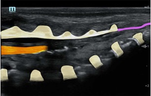 Caudal_Long_Annotated.jpg