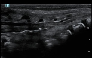 Caudal_Long.jpg